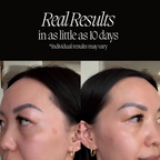 GLOW: Red Light Therapy Mask in Onyx