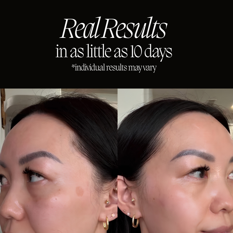 GLOW: Red Light Therapy Mask in Onyx
