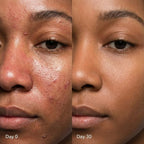 GLOW: Red Light Therapy Mask in Onyx