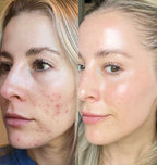 GLOW: Red Light Therapy Mask in Onyx